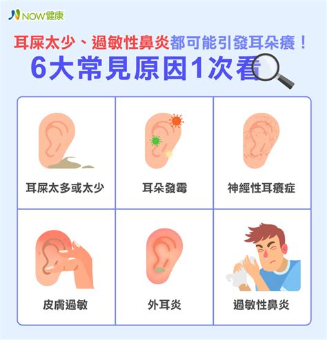 左邊耳朵癢|耳朵癢卻沒有耳屎，是耳朵發黴？專家曝6大原因、4緩解法 